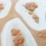 Kit 003 Prótesis de Imperfecciones y Relieves Cutáneos FX - Imagen 2